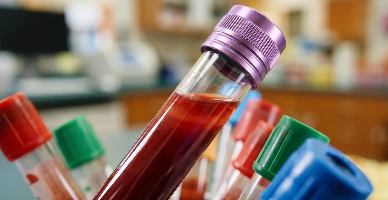 Extreme close-up macro shot of laboratory test tubes with blood samples showing rich red colors and scientific precision